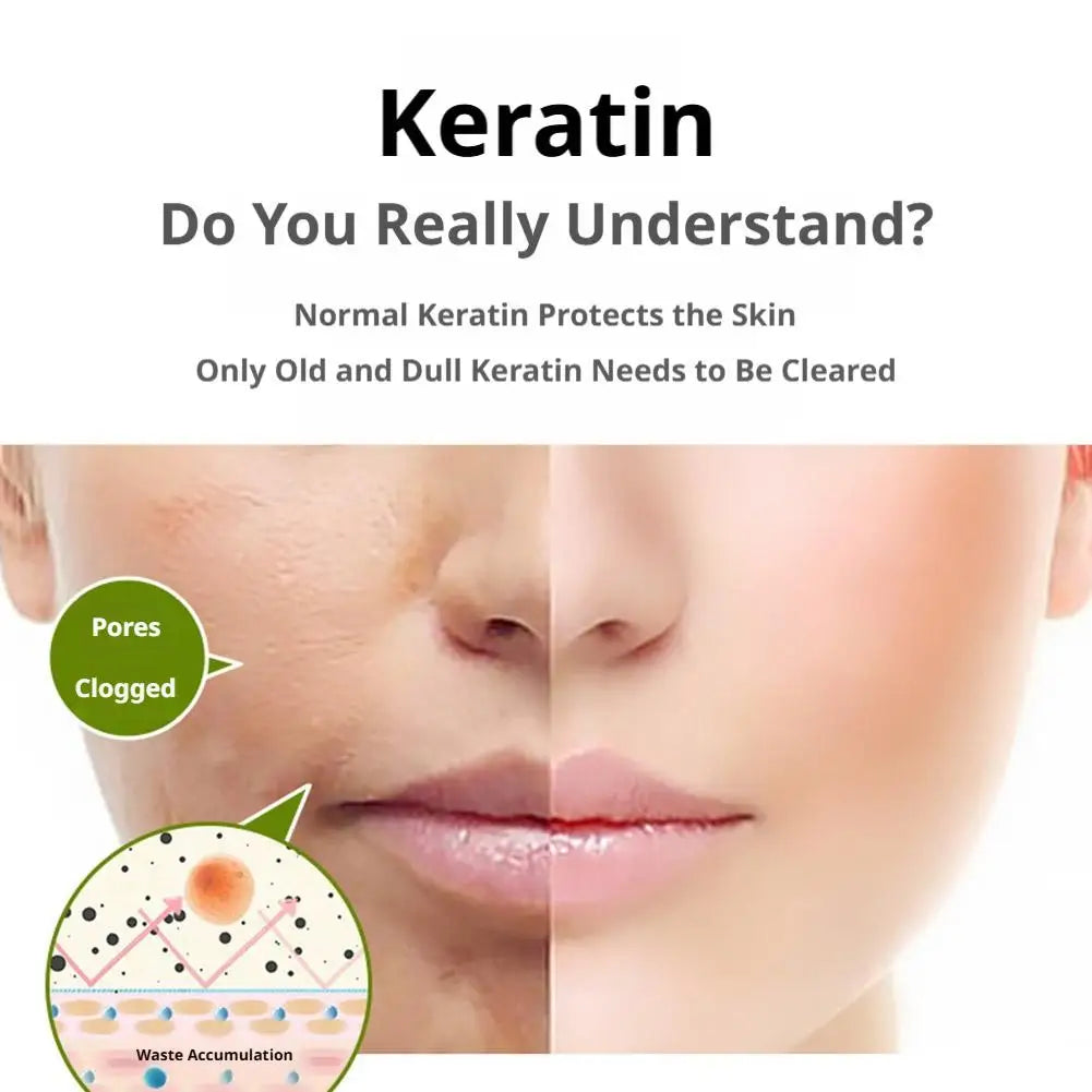 Exfoliating Facial Peeling Gel
