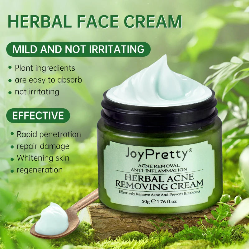 Acne Control Face Cream