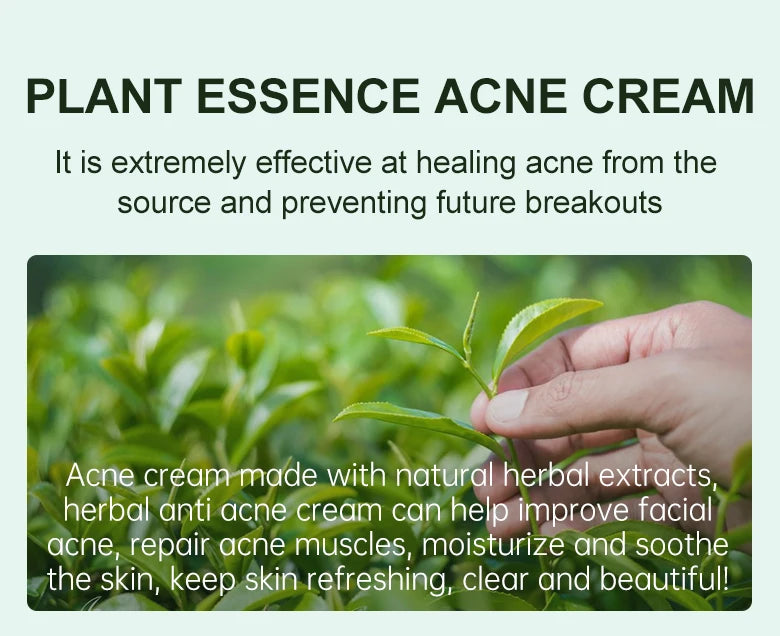 Acne Control Face Cream