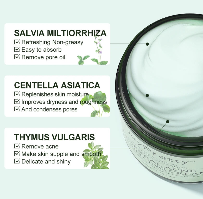 Acne Control Face Cream