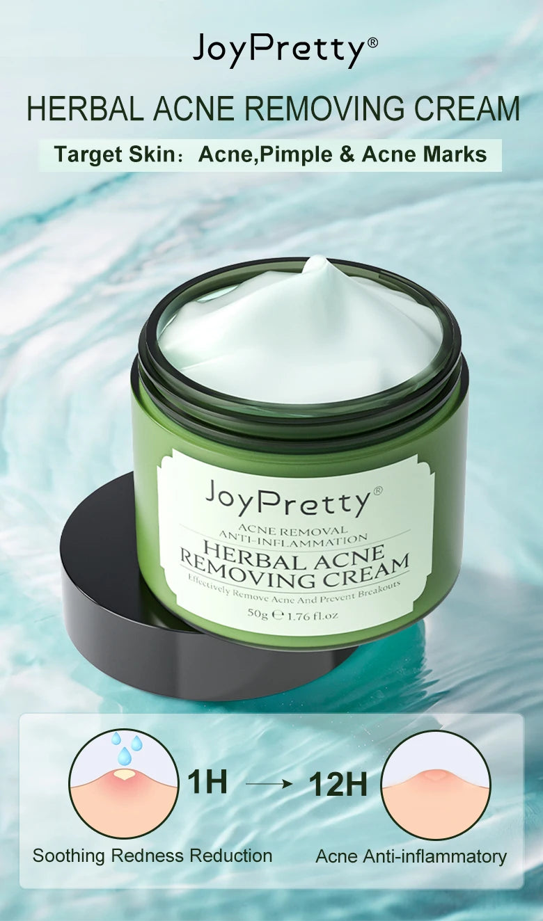 Acne Control Face Cream