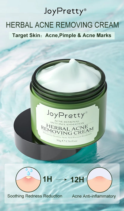 Acne Control Face Cream