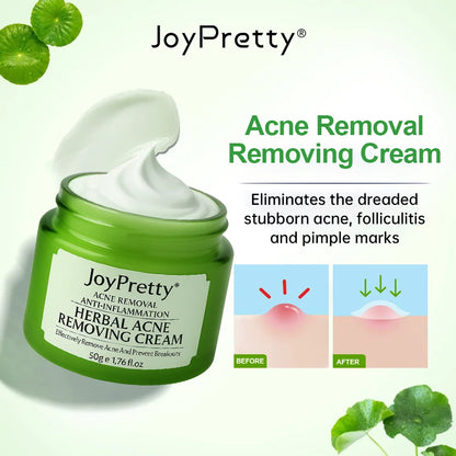 Acne Control Face Cream