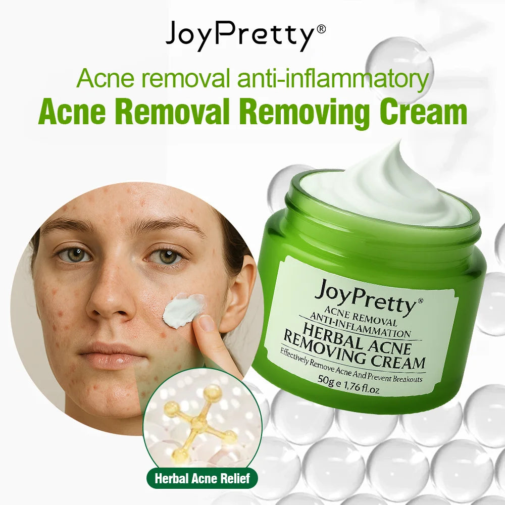 Acne Control Face Cream