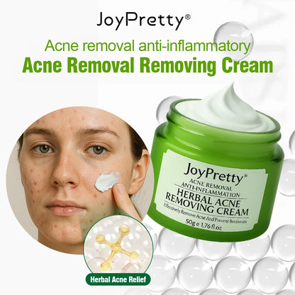 Acne Control Face Cream
