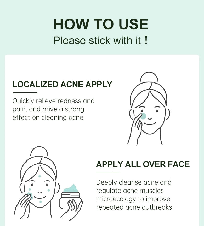 Acne Control Face Cream