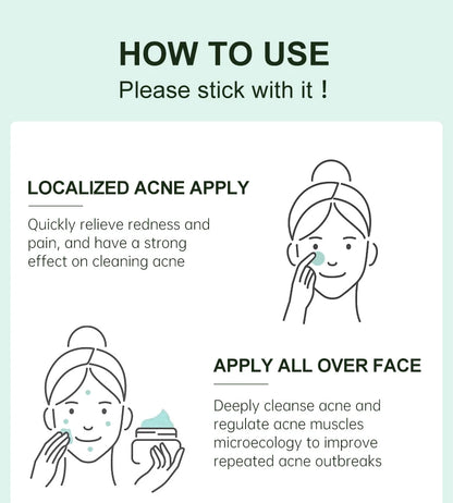 Acne Control Face Cream