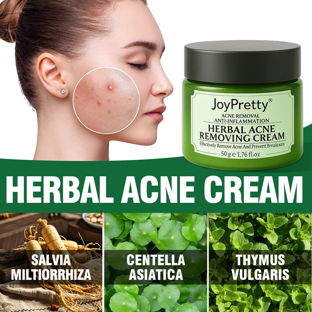 Acne Control Face Cream