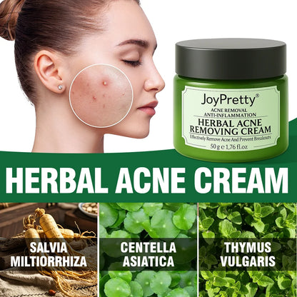 Acne Control Face Cream